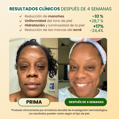 Jabón Anti-Manchas y Hiperpigmentación con Cúrcuma (+100 g GRATIS)