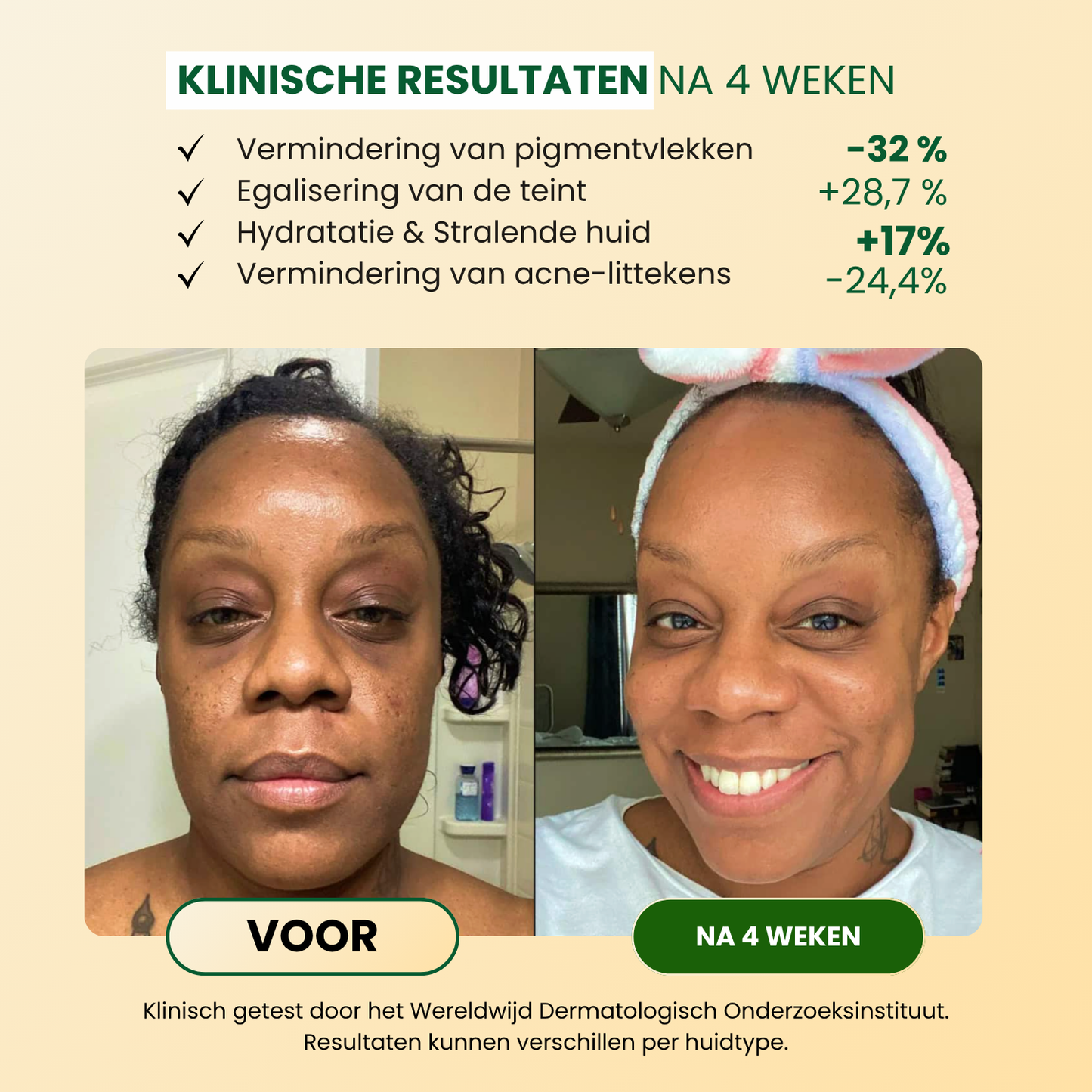 Kurkuma Anti-Vlekken & Anti-Hyperpigmentatie Zeep