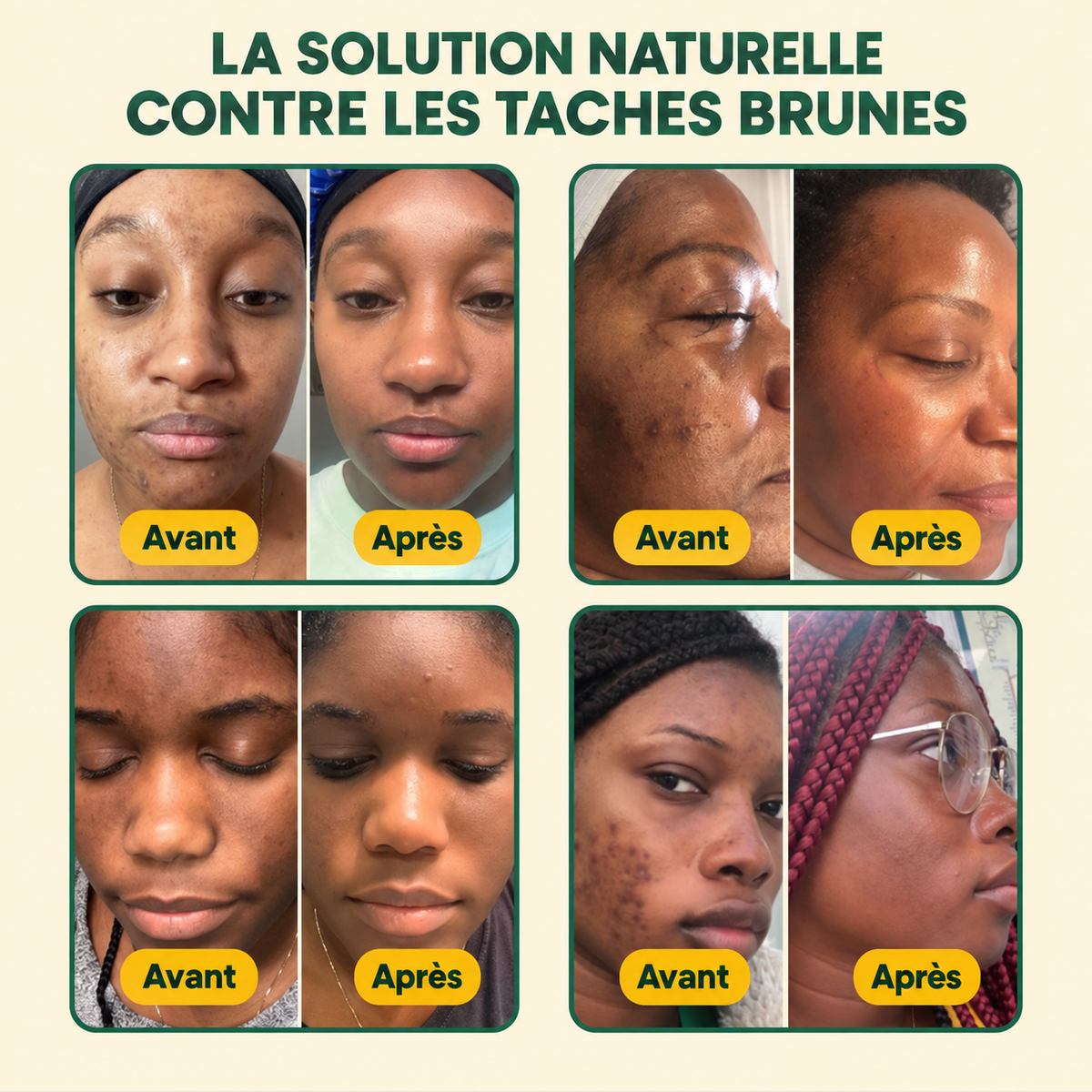 Masque De Nuit Anti-Taches au Curcuma